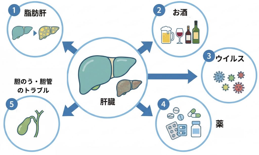 健診で肝機能障害を指摘された方へ | 千里丘内視鏡クリニック